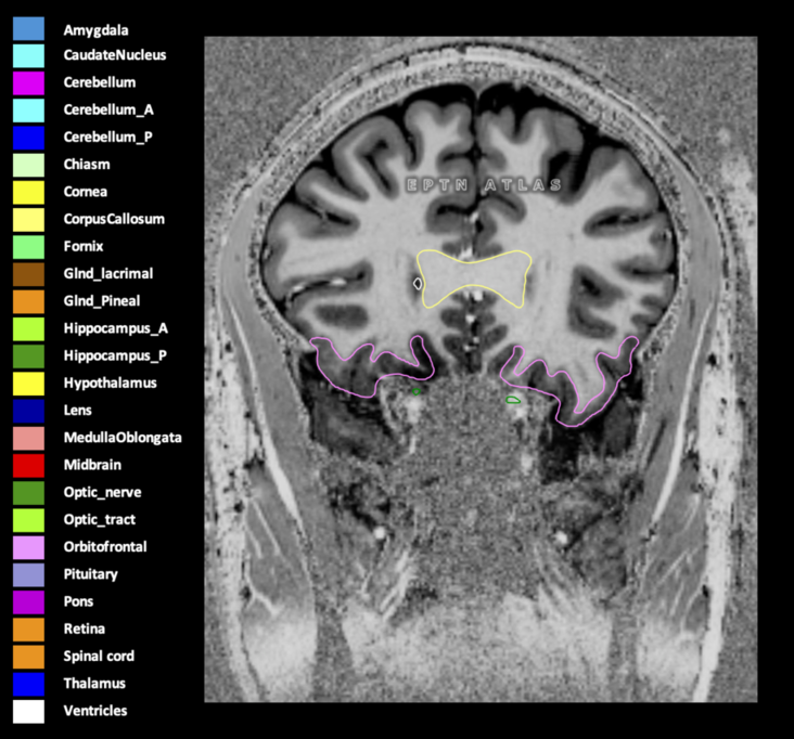 Z=24.76