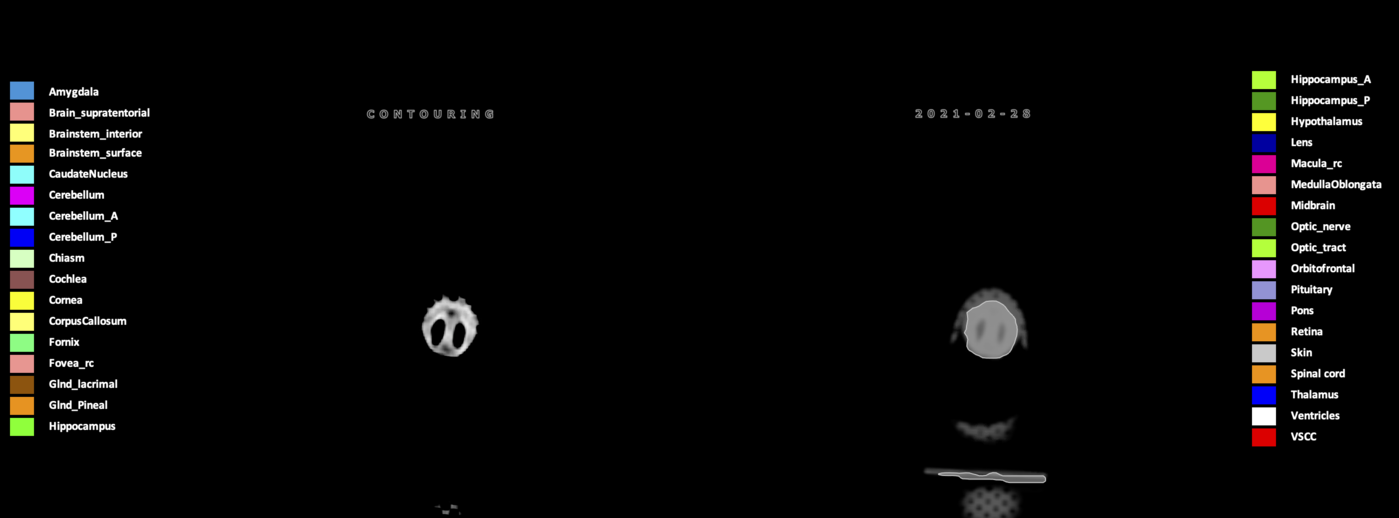 Z=12.48