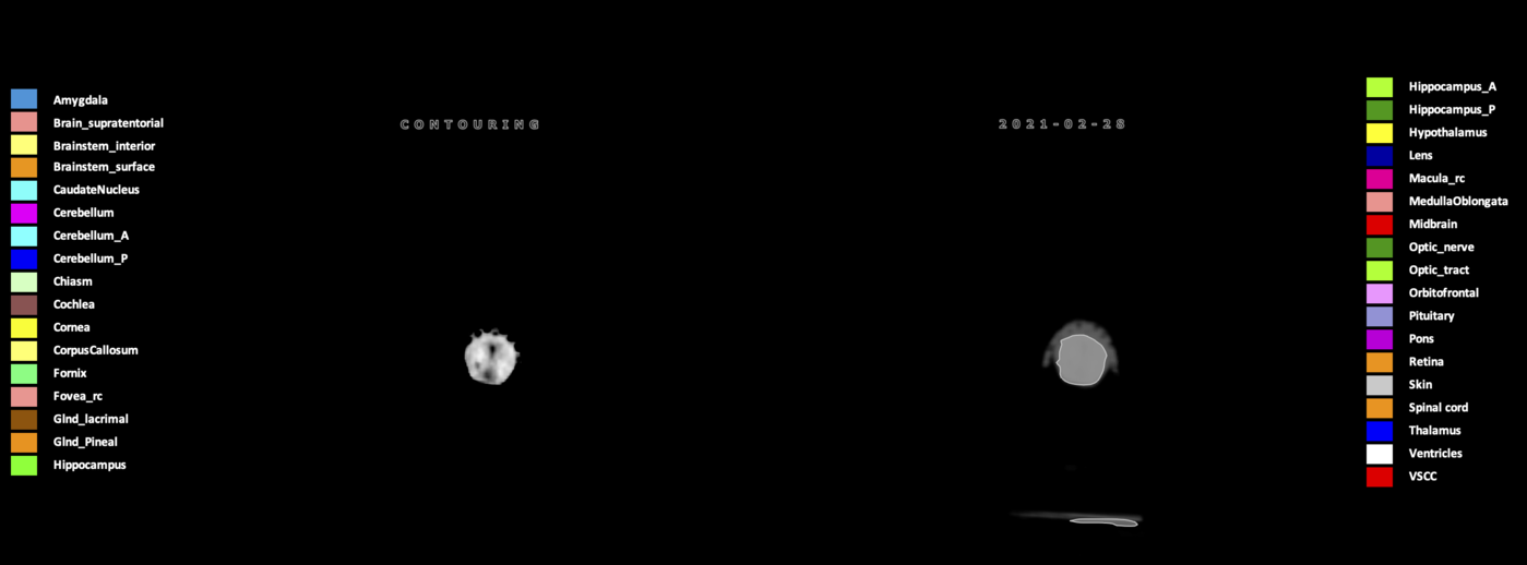 Z=12.68
