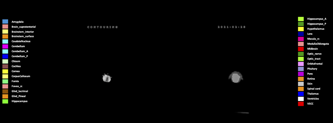 Z=12.88