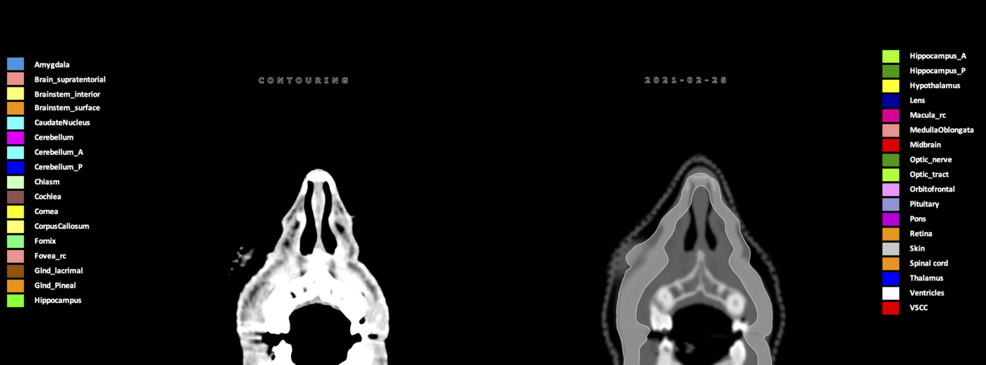 Z=9.98