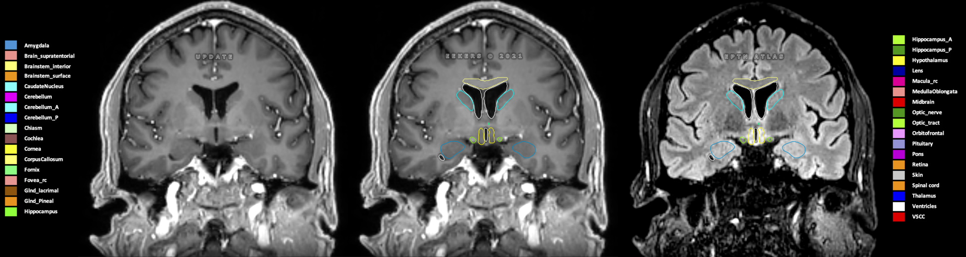 Z=0.78