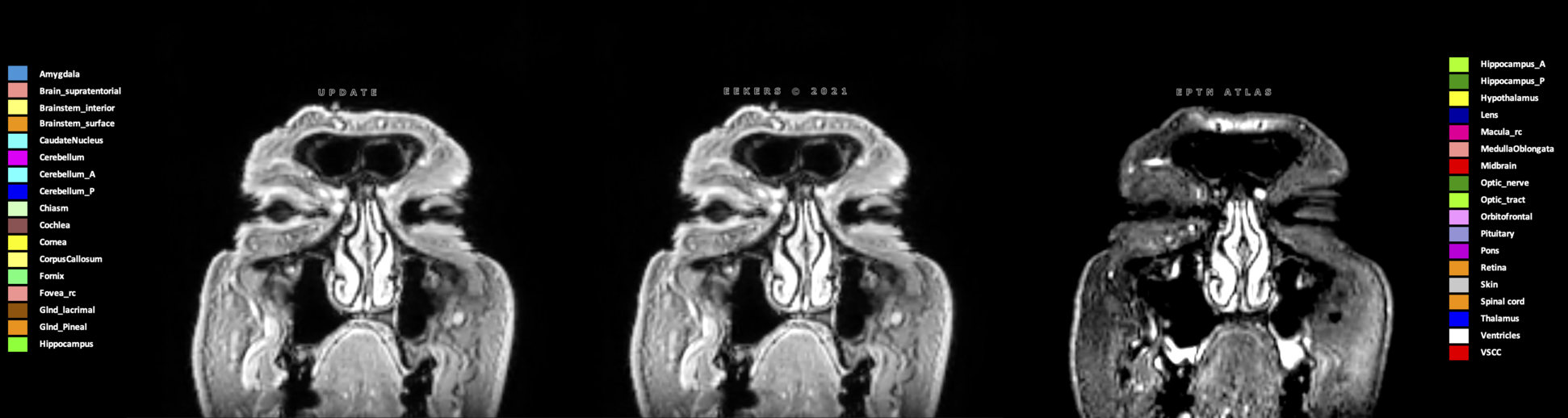 Z=8.08