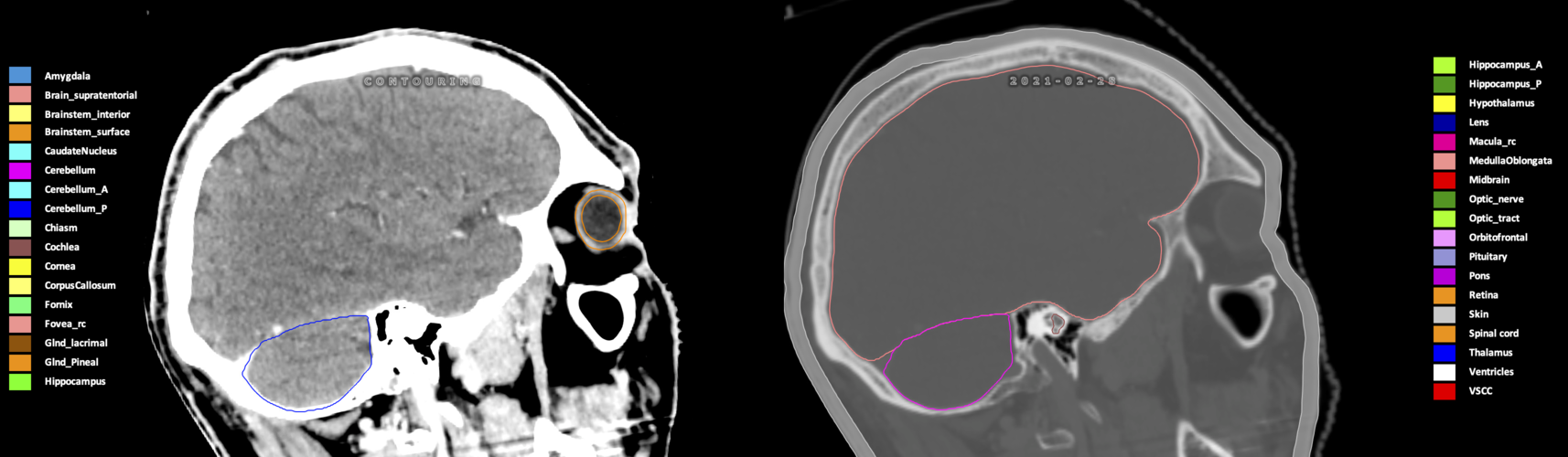X=-3.56