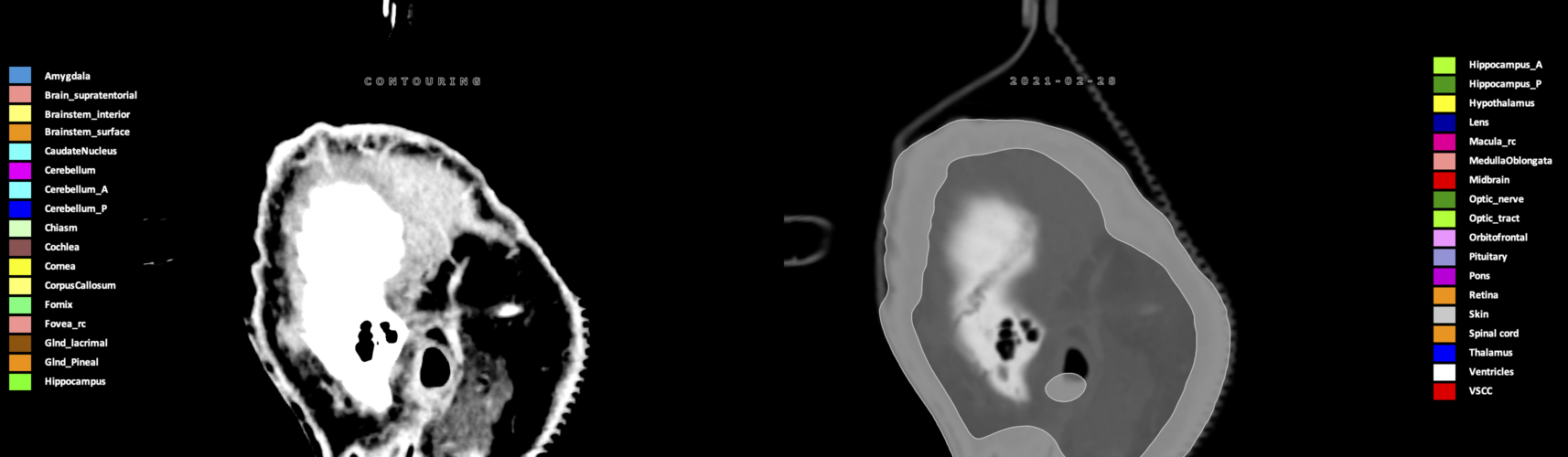 X=-6.96