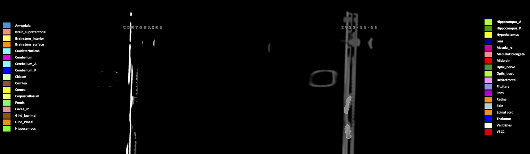 X=-9.26
