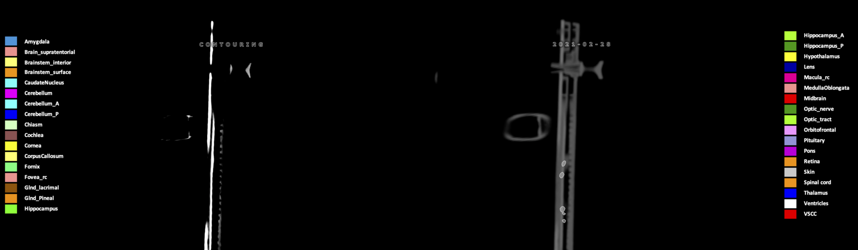 X=-9.36