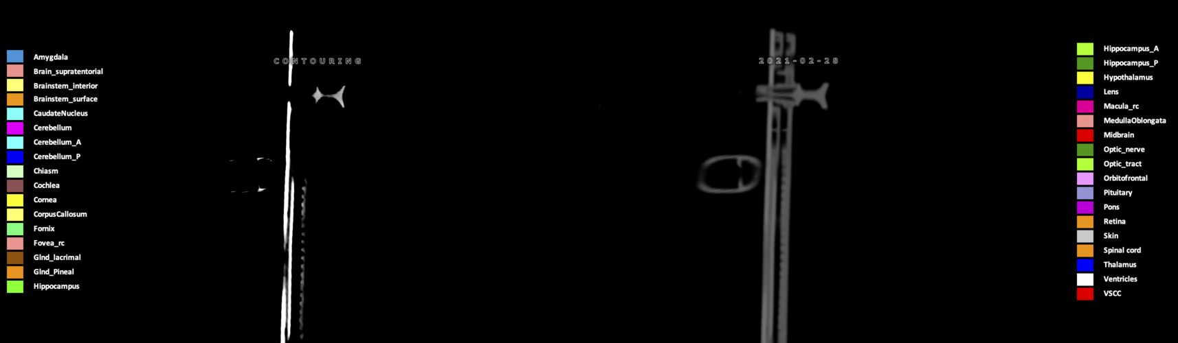 X=-9.46