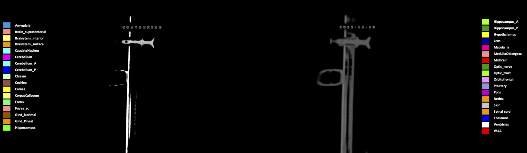 X=-9.66