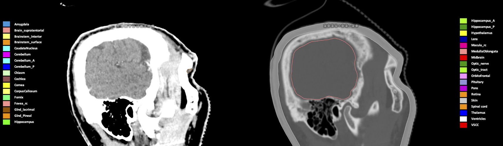 X=5.74