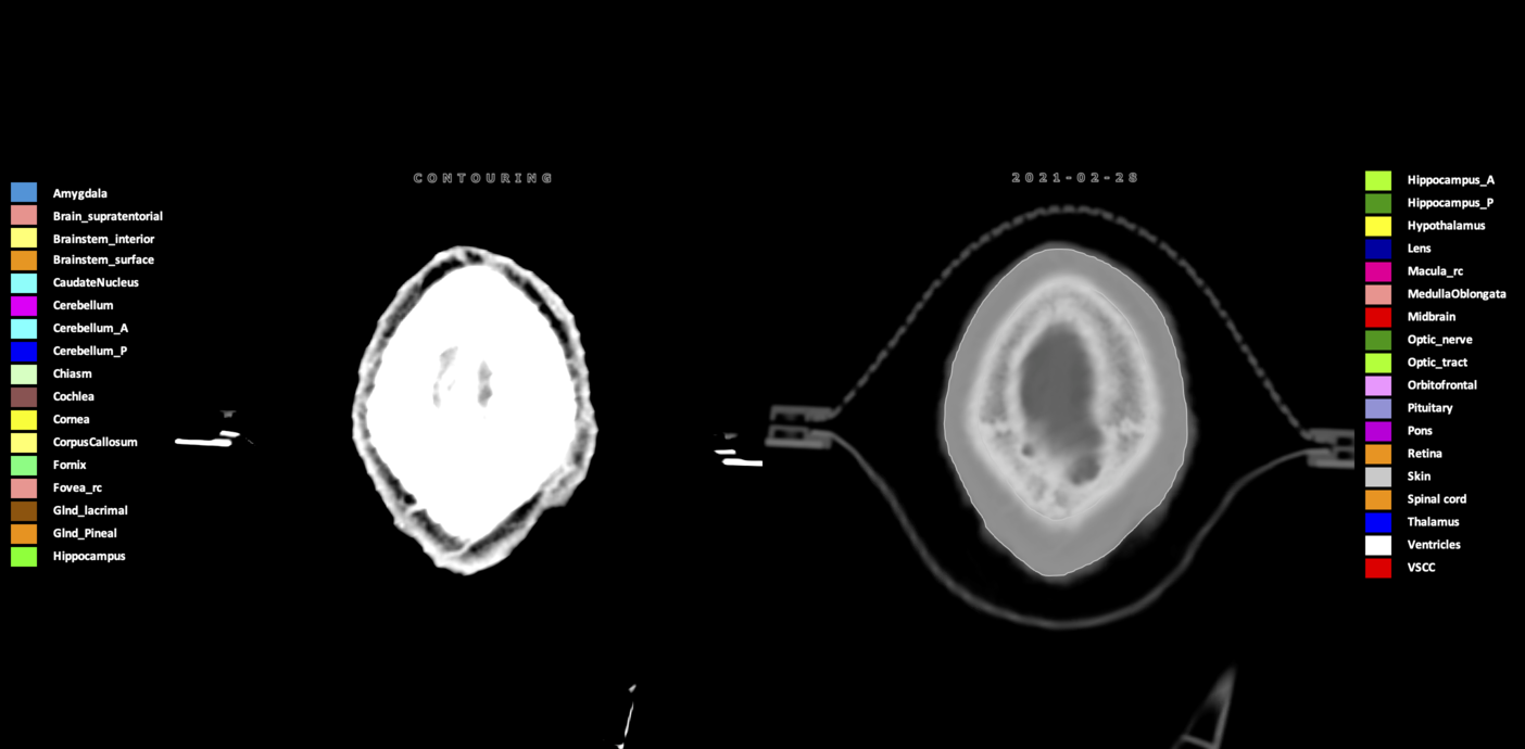 Y=159