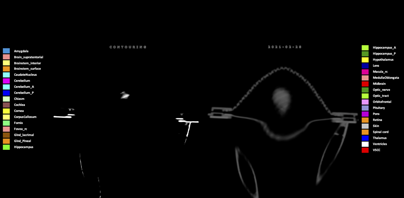 Y=173