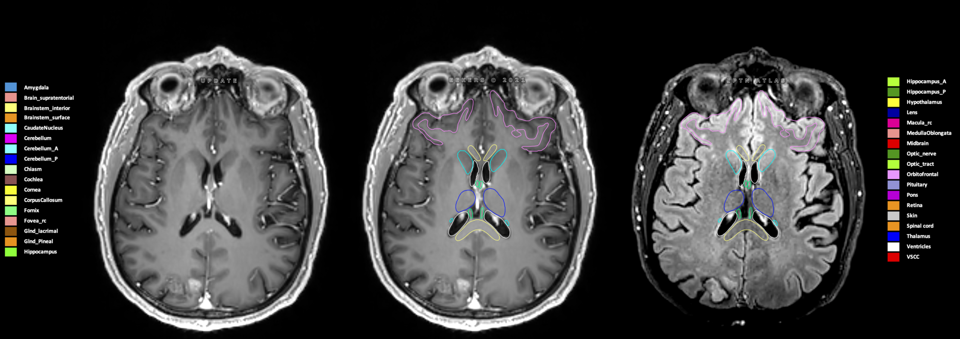 Y=98