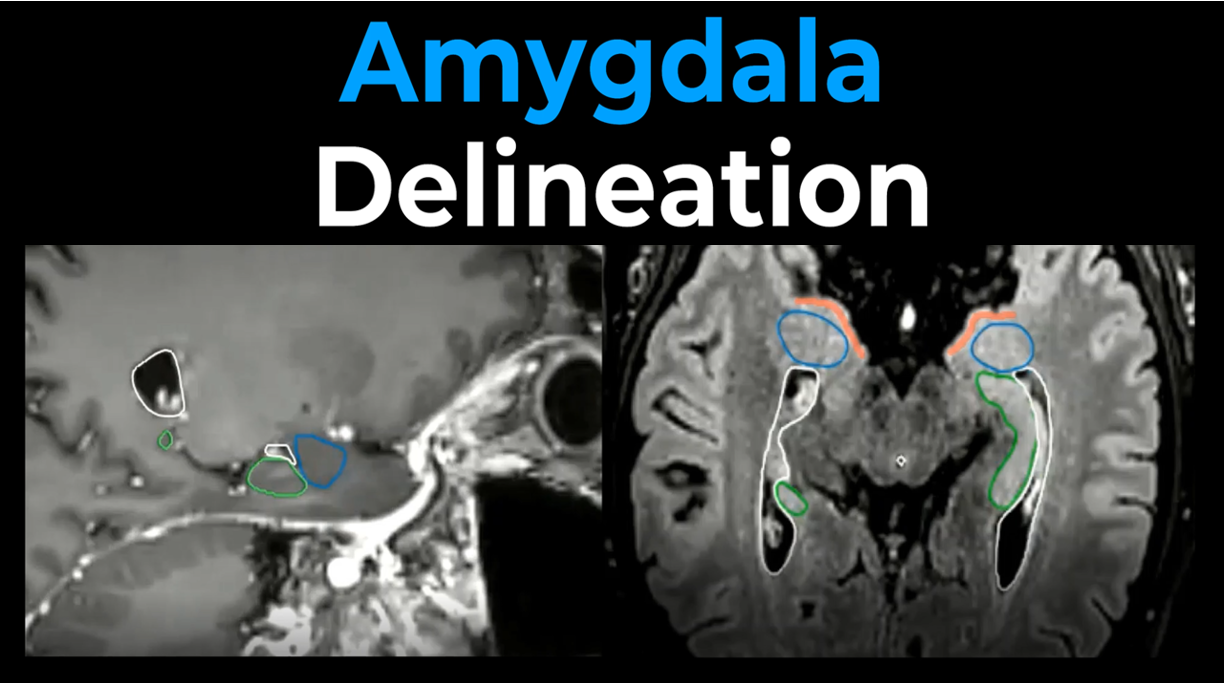 Amygdala