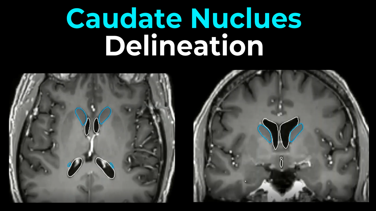 Caudate Nucleus