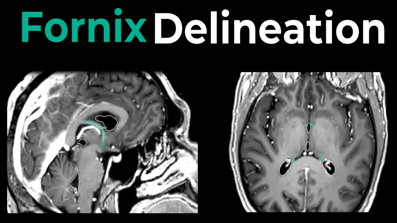 Fornix