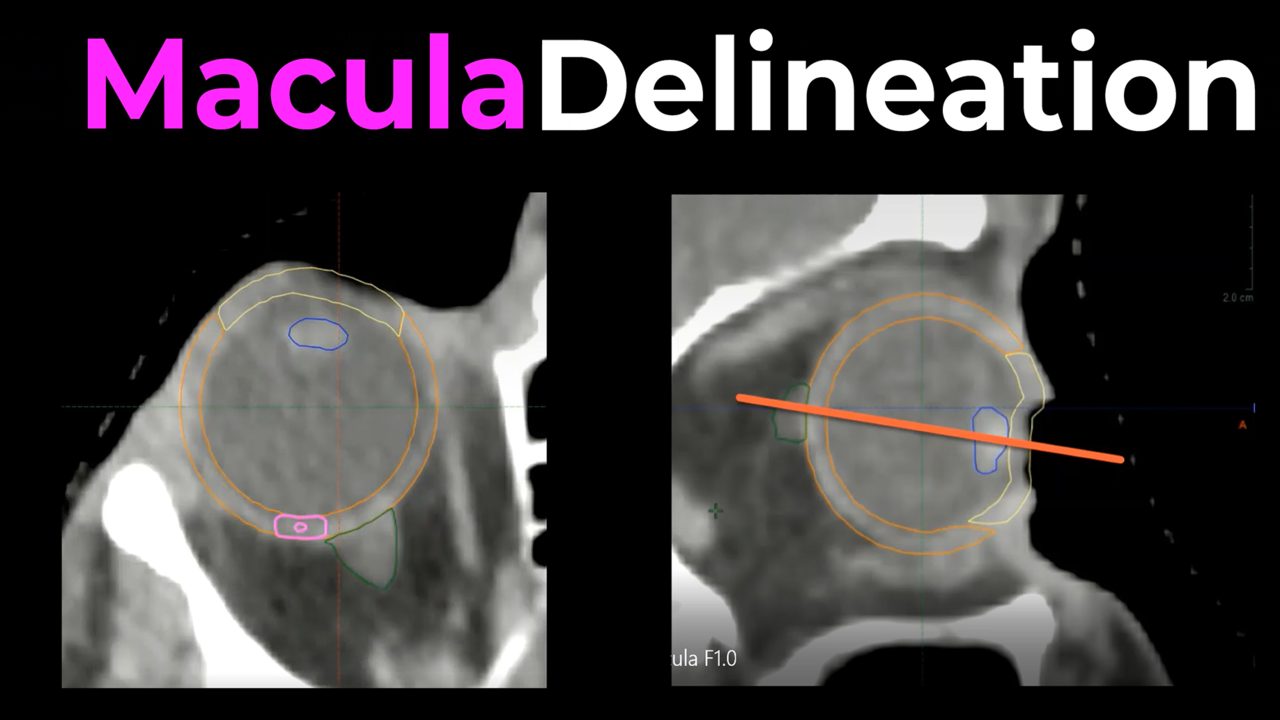 Macula