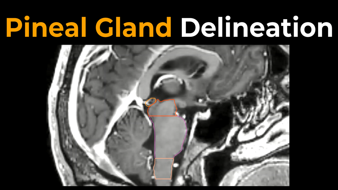 Pineal Gland