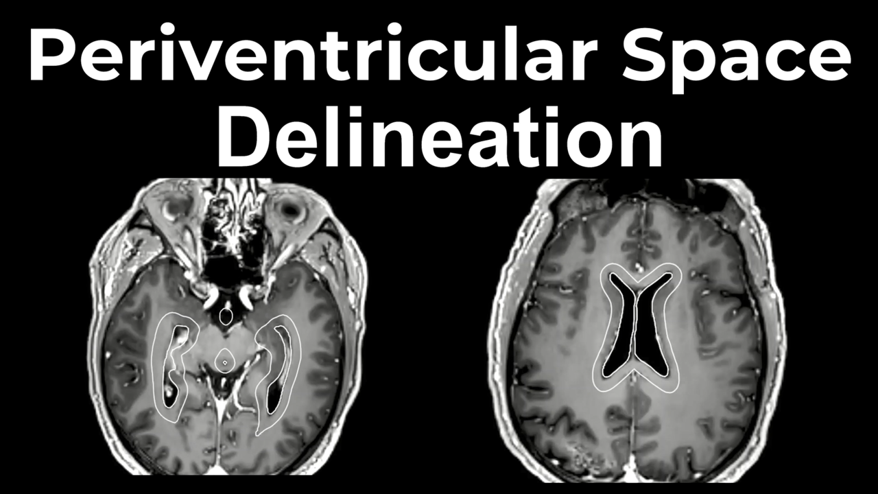 Periventricular Space