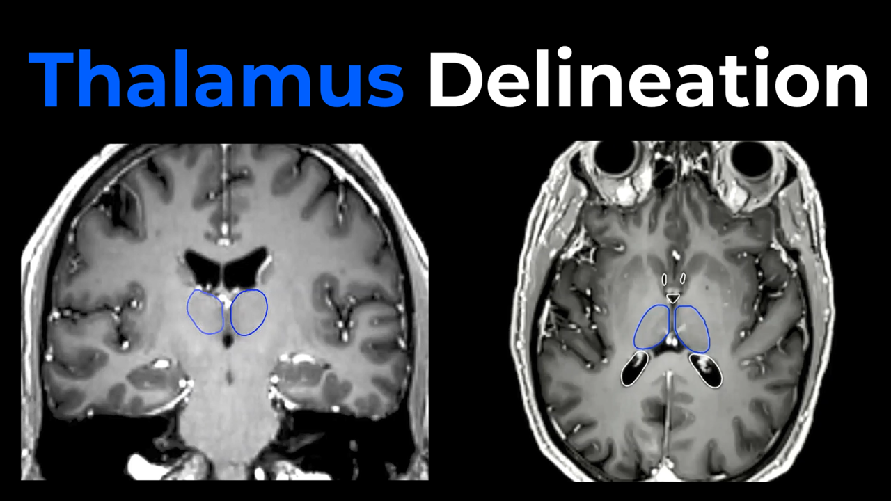 Thalamus